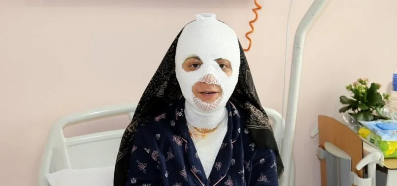 Patlayan düdüklü tencere hastanelik etti