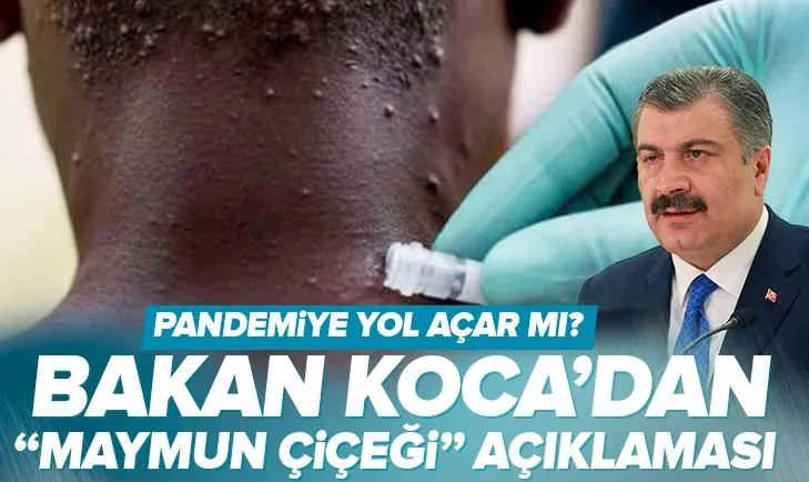 Sağlık Bakanı Koca’dan Maymun Çiçeği hastalığı açıklaması