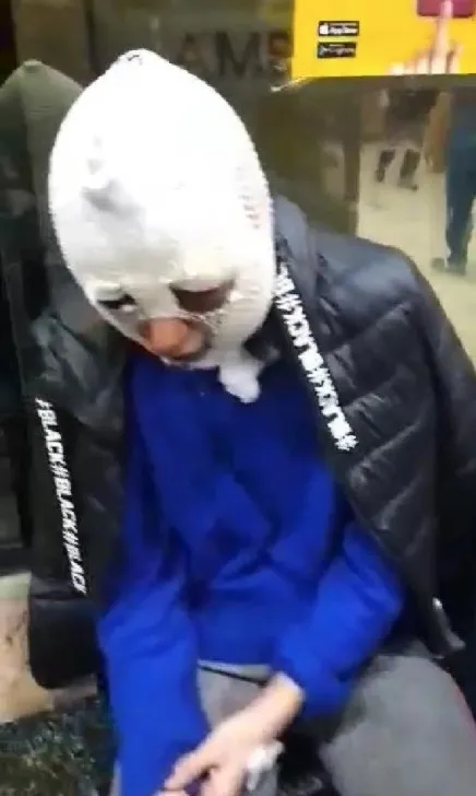 eski-sozlusunu-darp-etti-tecavuz-etti-basindan-asagi-kizgin-yag-doktu-serbest-birakildi-1646830752318.jpg Eski sözlüsünü darp etti, tecavüz etti, başından aşağı kızgın yağ döktü: Serbest bırakıldı - 3