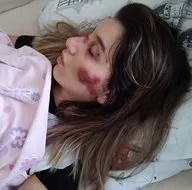 Adana’da feci kaza! Kızım yataktan kalkamıyor