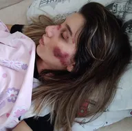 Adana’da feci kaza! Kızım yataktan kalkamıyor