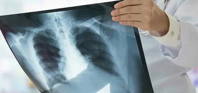 Zatürre en çok onları tehdit ediyor: Kimler zatürre aşısı yaptırmalı?