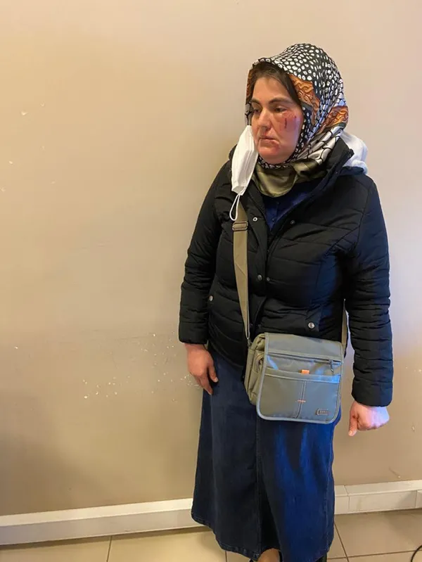 Yolda yürürken tanımadığı kişi tarafından darp edildi: İnsanlar tutmasa beni öldürebilirdi - 3