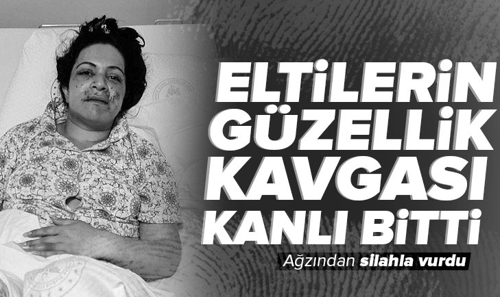 Eltilerin güzellik kavgası kanlı bitti! Ağzından silahla vurdu