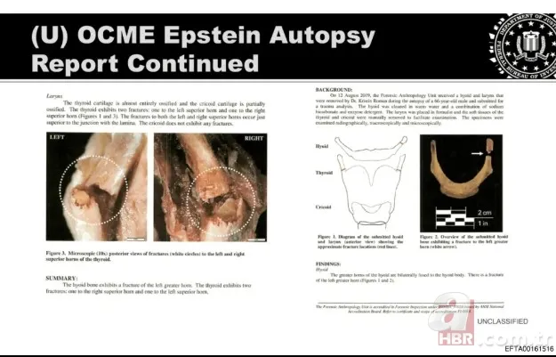 Sapık finansçı Epstein'in ölümünden kan donduran görüntüler! ABD Adalet Bakanlığı paylaştı 6