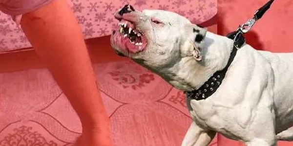 İngilizlerin canavarlaştırdığı köpek: Pitbull! Asiye’nin uğradığı saldırıyla ilgili bilinmeyen detaylar! Pitbullar nasıl bu hale geldi?