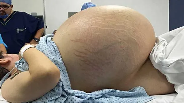 Hamile olduğunu düşünüyordu, doktora gittiğinde büyük şok yaşadı! - 1