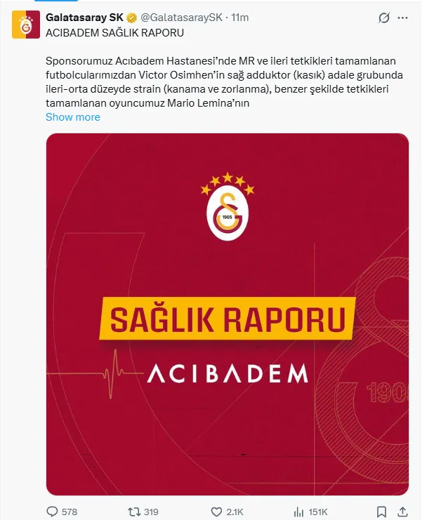 1788689580836.png Galatasaray'dan Victor Osimhen ve Mario Lemina için sakatlık açıklaması! - 1