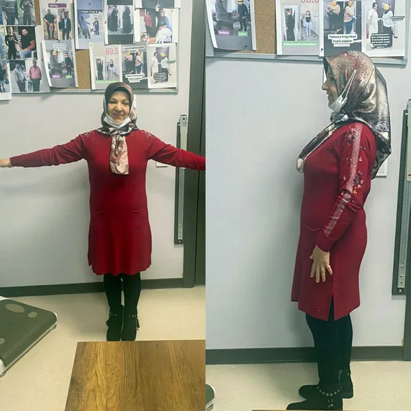 2 yılda 95 kilo verdi: Çorabımı bile giyemiyordum
