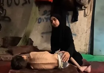 Gazzelileri hem bombalar hem açlık öldürüyor: "Artık çocuklarımın kemikleri görünüyor"