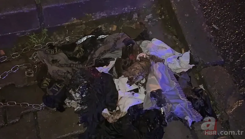 Kuaförde korkunç olay! 14 yaşındaki çocuğun tüm vücudu yandı 4