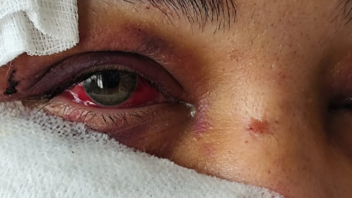 Kan donduran dehşet: “Güzelliğini elinden alacağım” dedi, yüzünü parçaladı! Tutuklandı