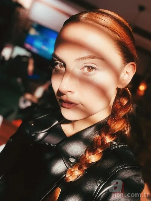 Sipahi'nin Ezgi'si Başak Gümülcinelioğlu estetik harikası çıktı! Eski halini gören şaştı kaldı 3