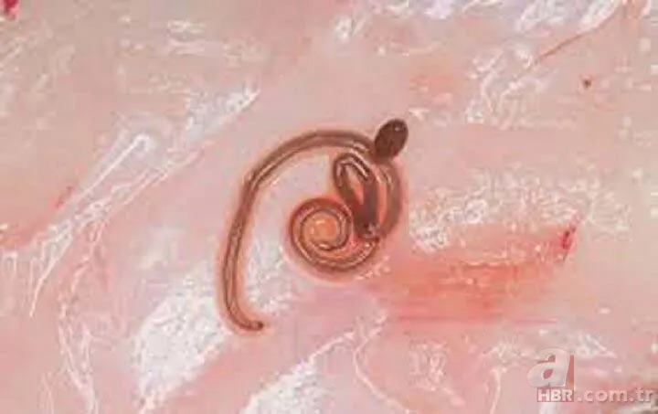 İnanılmaz olay! Dünyada bir ilk: Beyninden çıkan şey herkesi şoke etti 2