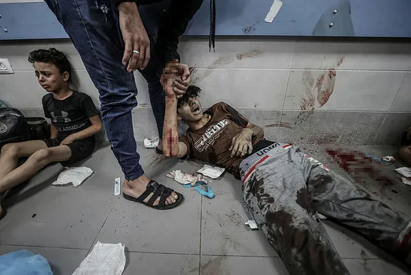 İsrail Gazze’deki El-Ehli Baptist Hastanesi’ni vurdu! 500’den fazla can kaybı...