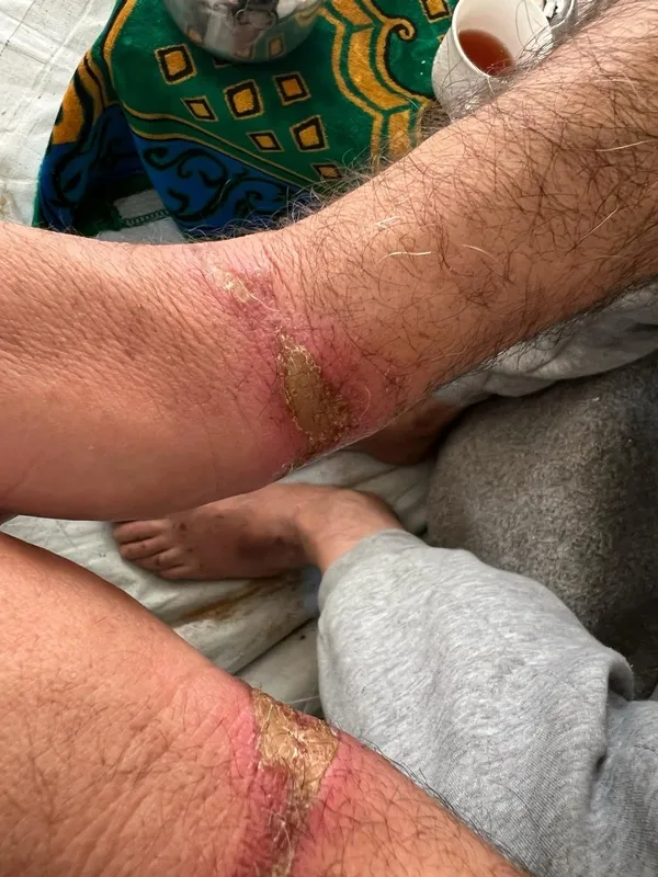 1708188694268.jpg Terör devleti İsrail'in alçak vahşeti! El-Emel Hastanesi'nde alıkonulan 2 doktora işkence: Fotoğraflar ortaya çıktı... - 2