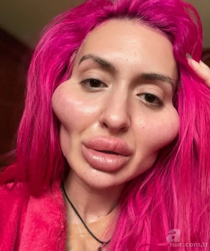 Fatih’te estetik yaptıran Bulgar modelin hayatı kabusa döndü! ‘Örümcek ağı’ operasyonu bakın ne hale getirdi? 18