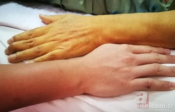 Meğer 1000 yıl önce yazmış! İbni-i Sina'nın şifa dağıtan tarifleri! Hastalıkları kökünden kazıyor! İşte o reçete 5