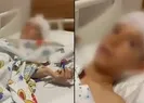 13 köpeğin saldırdığı Hamza toprağa verildi