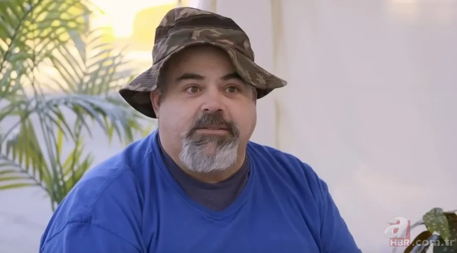 Sokağa şapka ile çıkıyordu! Başındaki şişlikten bakın ne çıktı 👩⚕️ Görenleri şaşkına çeviren olay 25