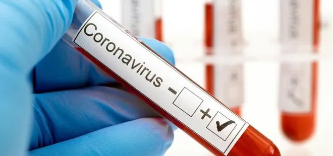 Güney Afrika’da coronavirüs nedeniyle ilk ölümler yaşandı
