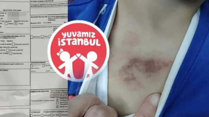 ibbye-ait-kreste-darp-ve-istismar-skandalinda-yeni-gelisme-polis-ekipleri-inceleme-baslatti-1769466774536.jpeg İBB'ye ait kreşte darp ve istismar skandalında yeni gelişme! Polis ekipleri inceleme başlattı