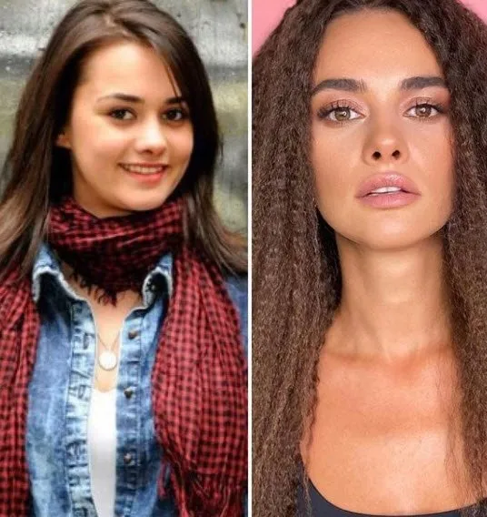 Kalp Yarası’nın Ayşe’si Yağmur Tanrısevsin’in estetiksiz hali pes