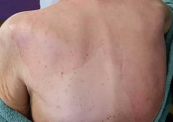İzmir'de huzurevinde ölüm olayında doktor hakkında yakalama kararı
