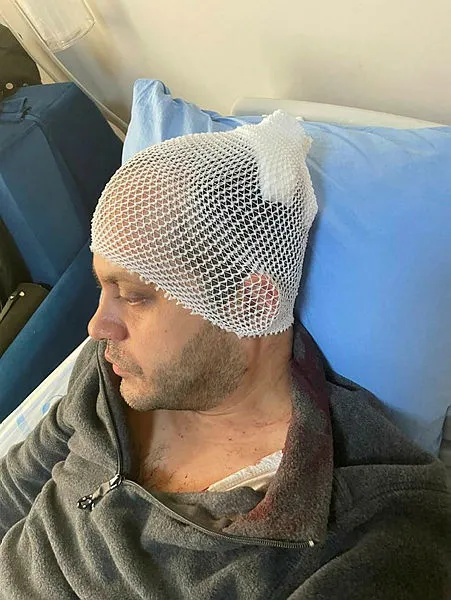 Bakan Fahrettin Koca'dan kafasına mermerle vurulan Doktor Sadık Oluk hakkında açıklama! "İnsanlık dışı" - 3