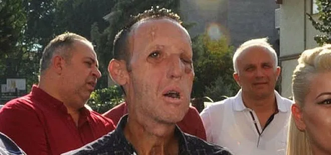 İlk yüz nakli yapılan Recep Sert suçüstü yakalandı! İlk vukuatı değil