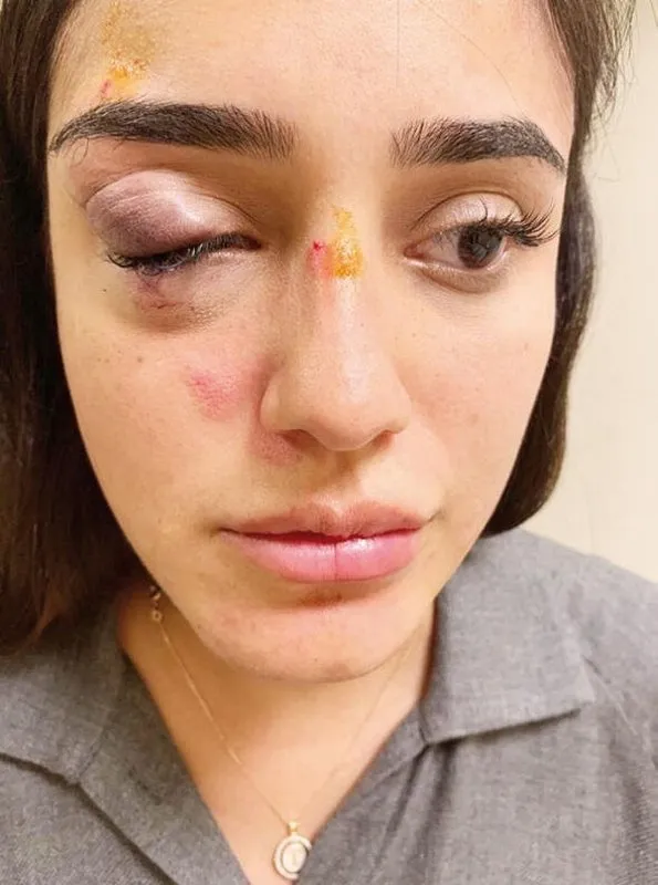 6 Aylik Hamileyken Darbedilen Ceren Kaplakarslan In Ikinci Kez Hamile Oldugu Ogrenildi
