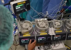 Sağlık teknolojisinde gurur günü! Yerli kalp akciğer makinesi "LIFELINE HLM" ilk ameliyatından başarıyla çıktı