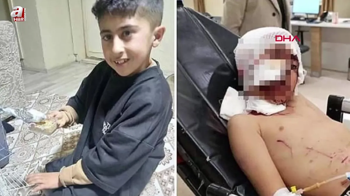 Erzurum'da sokak köpeği dehşeti!