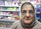 73 yaşındaki eşini döve döve bakın ne hale soktu!