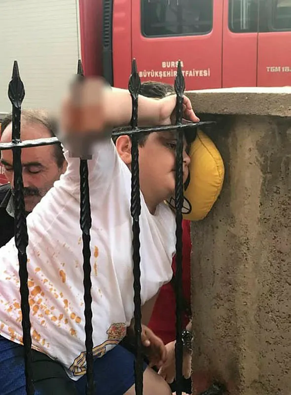 Bursa'da oynarken koluna demir korkuluk saplandı - 1