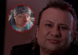 Onur Akay'ın burnu parçalandı! Başıboş pitbullun saldırısına uğradı