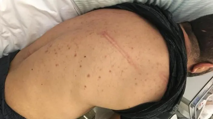 Alman polisi bir Türk’e işkence edip sokağa attı