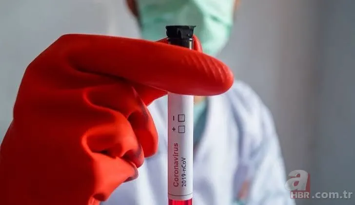 Çin'den Kovid-19 aşısıyla ilgili flaş açıklama! Son aşama kaldı 5