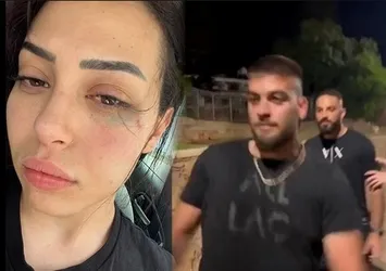 Dişlerini kırıp duvardan itmişlerdi! İlk kez A Habere’e konuştu | Türk kıza ırkçı saldırıda yeni gelişme