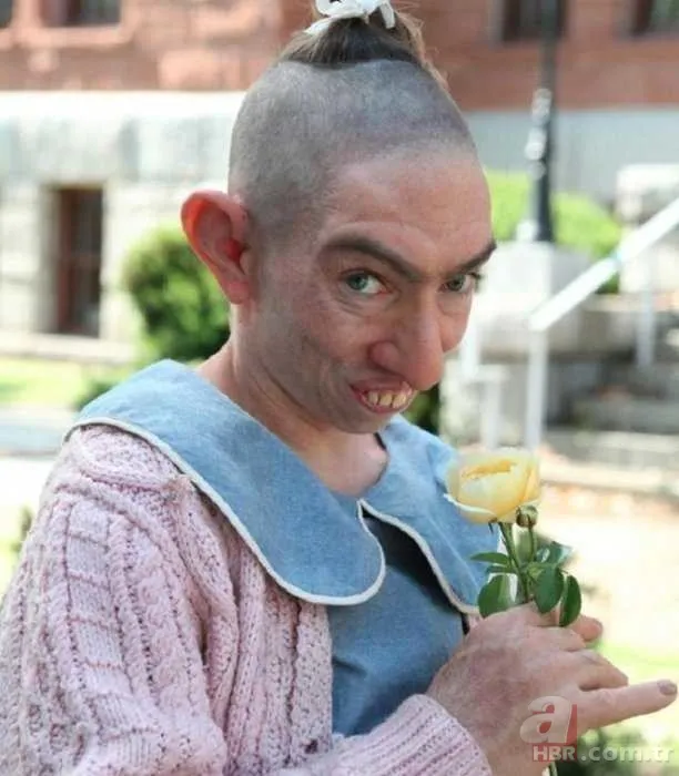 Ünlü oyuncuyu görenler gözlerine inanamadı! Tanınmaz hale geldi 15