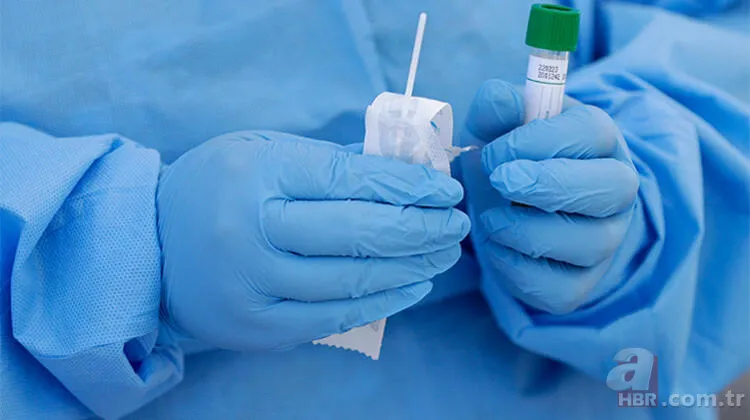 Fırsatçılar bunu da yaptı! Bedava olan corona virüs (koronavirüs) testi için 1250 TL aldılar 1