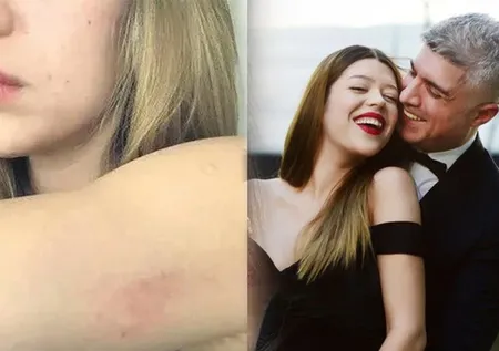 Özcan Deniz'den şiddet mi gördü? Feyza Aktan o fotoğraflara yanıt verdi