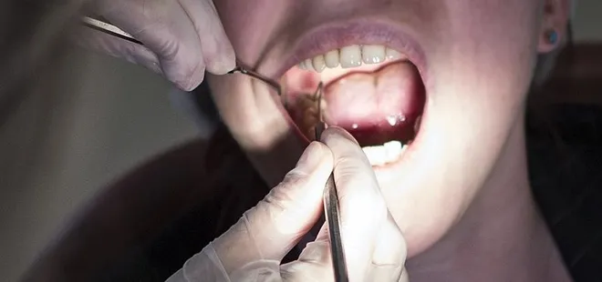 Sigara her nefeste dişleri içten çürütüyor