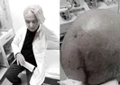 Maske uyarısı yapan doktorun kafasını taşla yardı