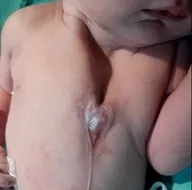 Kalbi dışarıda doğdu! Mucize kurtuluş...