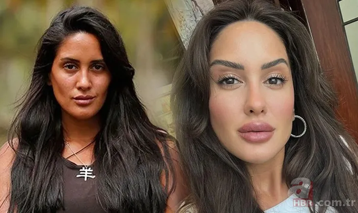 Survivor'un eski yarışmacısı Sahra Işık değişimiyle pes dedirtti! Estetik öncesi ve sonrası... 1