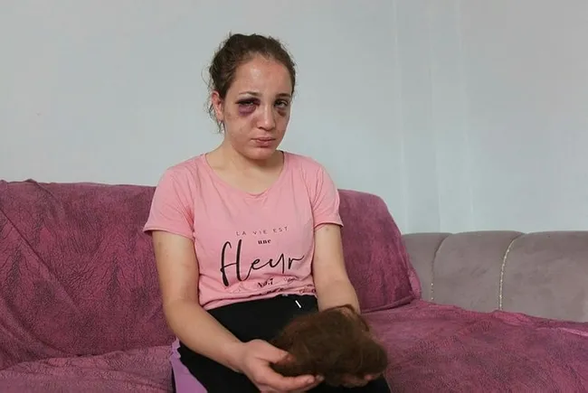 Aydın'da işkenceci koca 3 çocuğunun annesini bu hale getirdi - 3