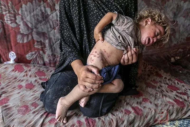 ABD'li doktor soykırımcı İsrail'in acımasızlığını herkese duyurdu: Karnından ve göğsünden vurulmuş çocuklar gördüm 2