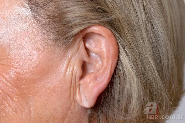 Kulak memesindeki çapraz çizgi ne işe yarar? 2