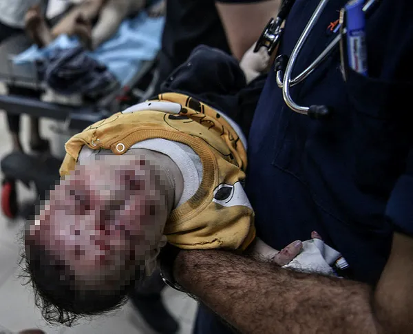 1698169596190.jpg Binlerce Filistinli ölümle burun buruna! BM ajansı duyurdu: Yarın durdurmak zorunda kalacağız - 1